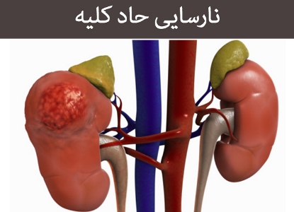مطالبی که بیماران پیوندی و دیالیزی باید بدانند 2